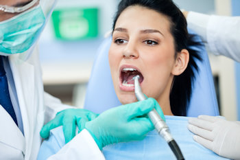 Dental Fillings