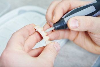Porcelain Fixed Bridges for Missing Teeth