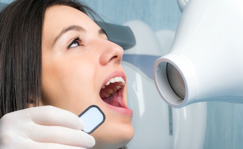 Digital Radiography at our Chandler office